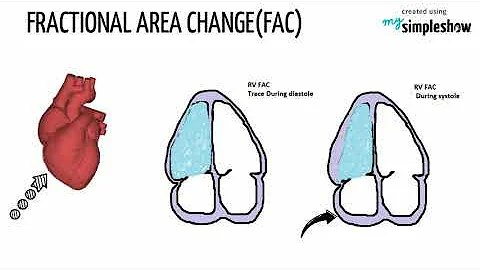RIGHT VENTRICULAR SERIES PART 2 - RV FUNCTION ASSESSMENT METHODS