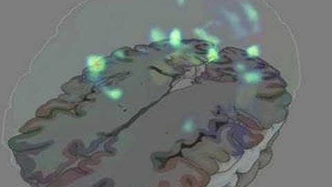 Illustrative Visualization and Exploration of MR/fMRI Data