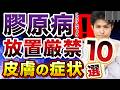 膠原病の初期症状は“肌”に出る？皮膚病変10選【専門医が徹底解説】