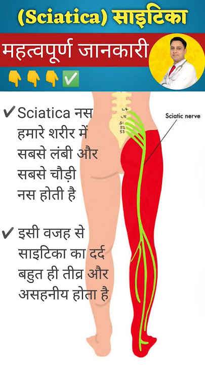 Sciatica Ka Dard #shorts #physiodrdeepaksoni