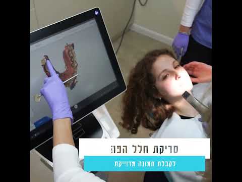 ד"ר קטרינה- השתלות שיניים ושיקום הפה בחדרה