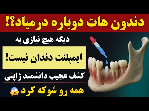 کشف بزرگ دانشمند نخبه ژاپنی دندان ها دوباره رشد می کنن مثل بچگی بدون ایمپلنت