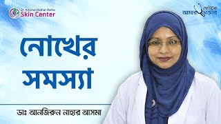 নখের সমস্যা ও সমাধান - Nail problem solution bangla - Signs of nail health screenshot 5