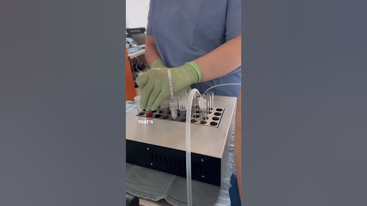 Watch An Egg Retrieval #eggretrieval #drlorashahine #fertilityspecialist #shorts