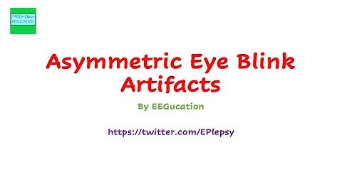 Asymmetric Eye Blink Artifacts