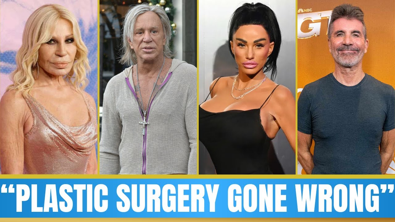 10 знаменитостей, ставших неузнаваемыми после неудачных косметических операций | Тогда и сейчас, ...