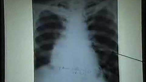 07 LietHoanh[bacsihoasung.wordpress.com].wmv