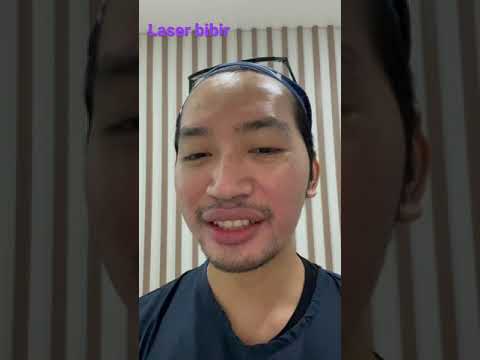 Laser bibir gelap kaget liat hasilnya, laser bibir hitam untuk mendapatkan bibir glowinglips laser by Fajrul Biak Sambas