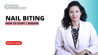 Nail Biting: Why it happens  & Effective Solutions
