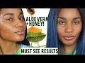 I used Fresh Aloe Vera + Honey on My Face for 5 DAYS| Got Rid of My Acne FAST |