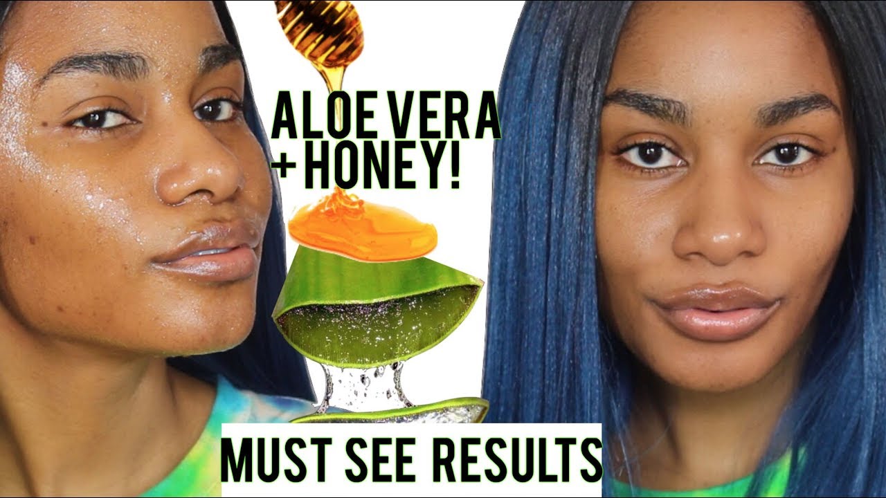 I Used Fresh Aloe Vera Honey On My Face For 5 Days Got Rid Of