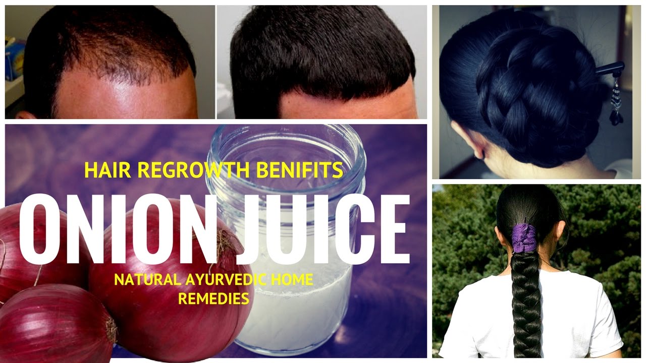 Onion Juice For Hair Regrowth Onion Juice For Hair Growth Best