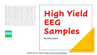 High Yield EEG Samples