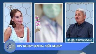 Genital Siğil Hpv, Kondilom Nedir?
