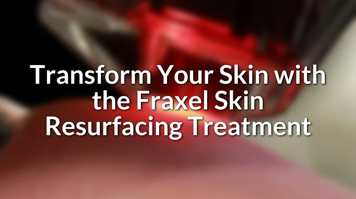 Transform Your Skin with Fraxel Skin Resurfacing | Lucere Skin