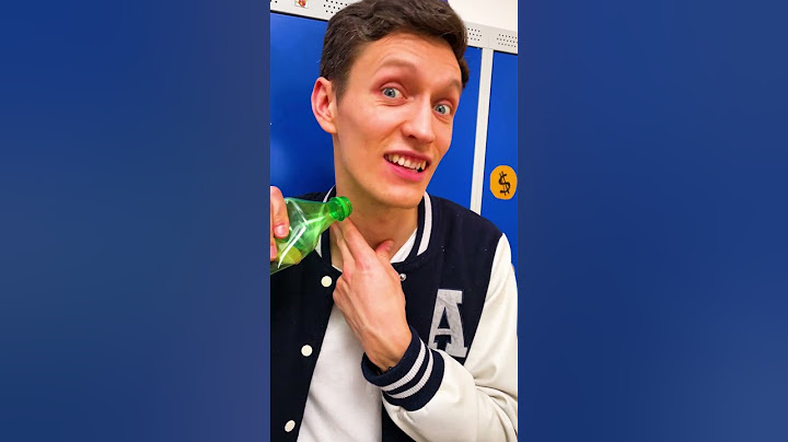 El truco del chupetón falso falla: ¡La broma sale mal de forma hilarante! 🤦‍♂️😂