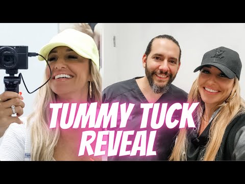Incredible Tummy Tuck reveal with Dr Tutela