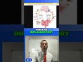 How does food affect your gut #guthealth #healthyfood #healthandwellness #functionalmedicine