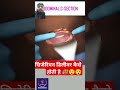 डिलीवरी कैसे होती है 🥵 #hospital #doctor #nursing #whowillbemylifepartnerta #dentist