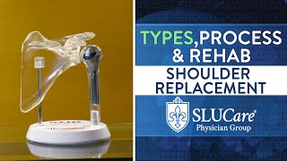 Shoulder Replacement Surgery: Types, Process & Rehab - SLUCare Orthopedic Surgery