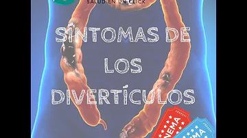 ¿Cómo se siente cuando tiene diverticulosis?