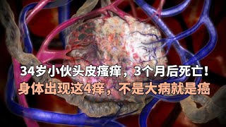 34岁小伙头皮瘙痒，3个月后死亡！身体出现这4痒，不是大病就是癌