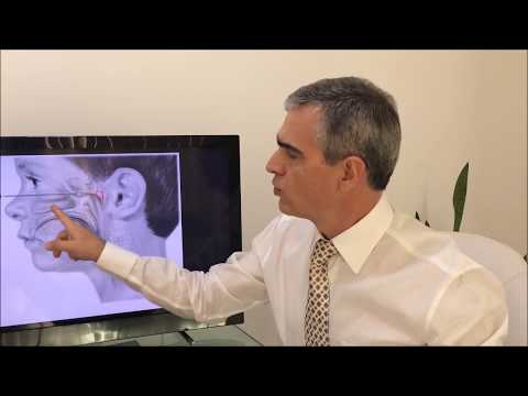 Vídeo: Adenoidite Aguda E Crônica - Sintomas, Tratamento, Adenoidite Em Crianças