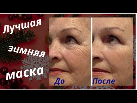 Видео: DIY: маски для лица для зимы