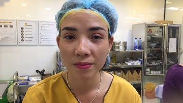 Trực Tiếp Chị Gái Sài Gòn Cắt Mí Vừa Xong Tại Dr.Hải Lê