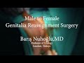 Male to Female Genitalia Reassignment Surgery