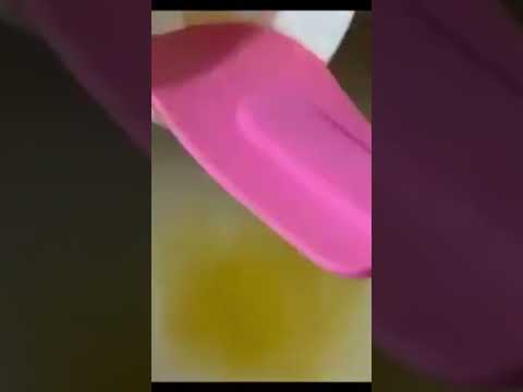 كرنكل التيك توك هو فطيرة الكاسترد اليونانية   