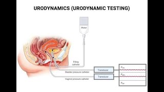 Components Of Urodynamic Studies Uroflowmetry, Post Void Residual Pvr Volume, Cystometry Filling