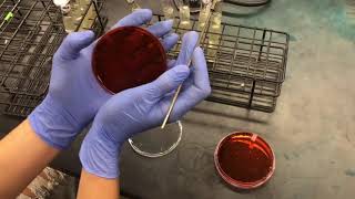 Exercise 21A: Most probable Number (MPN) method for coliform analysis