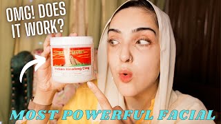 TRYING WORLDS MOST POWERFUL FACIAL🤯 *SHOCKED* | AZTEC INDIAN HEALING CLAY