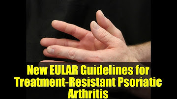 New EULAR Guidelines for Treatment-Resistant Psoriatic Arthritis