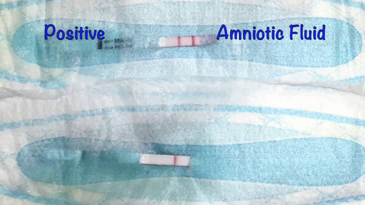A New Self-Test for Amniotic Fluid Leakage - YouTube