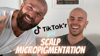 Tiktok Star Gets Scalp Micropigmentation in Los Angeles, CA