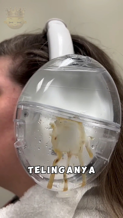 This Tool Gets All the Earwax Out!