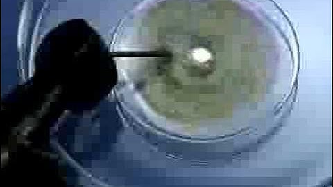 Pulsating Electrochemical Reaction: Mercury Beating Heart