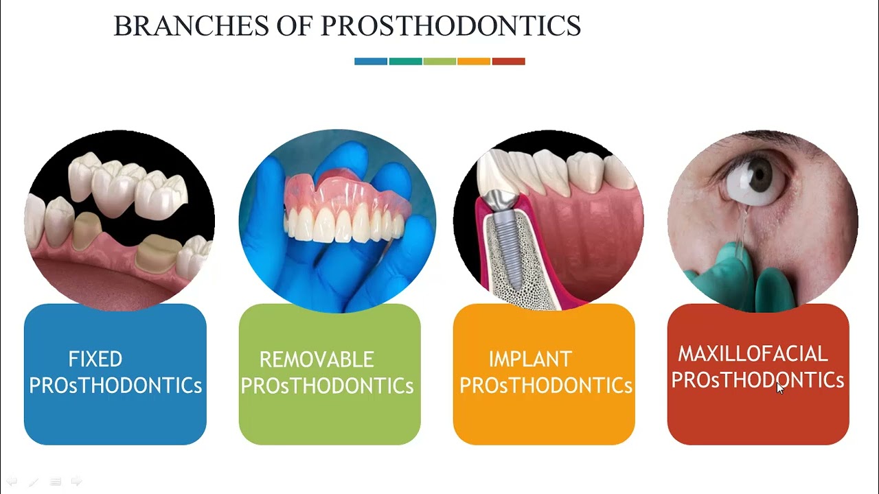 أكاديمية الجود - اسنان جامعة جازان - prosthodontics الاستعاضة المحاضرة ١