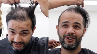 Shaving Off My Comb Over - Head Shave TRANSFORMATION *WOW*