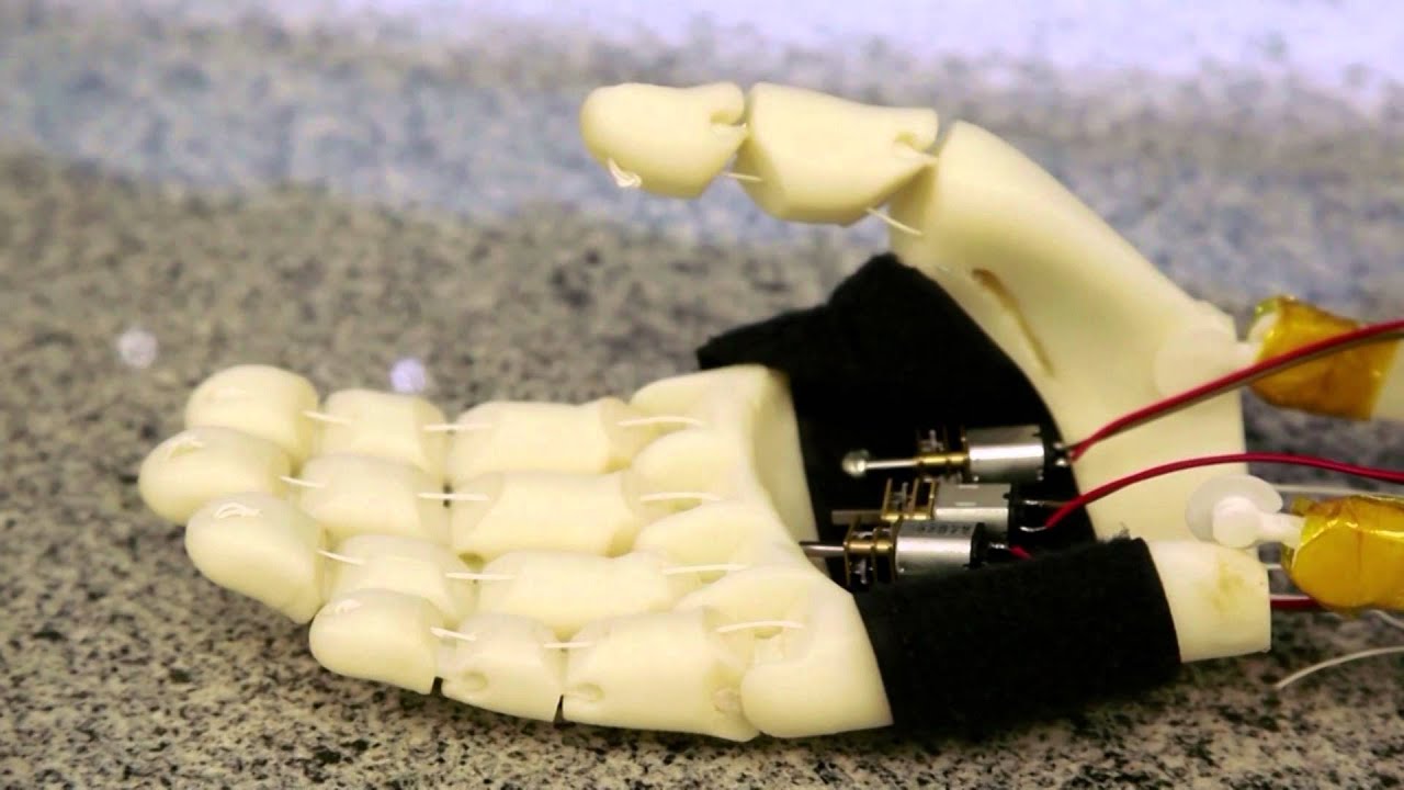 Boletim Conexões 2016- Prótese de Baixo Custo