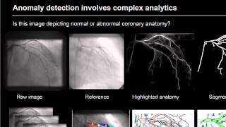 IBM Research Accelerating Discovery: Medical Image Analytics
