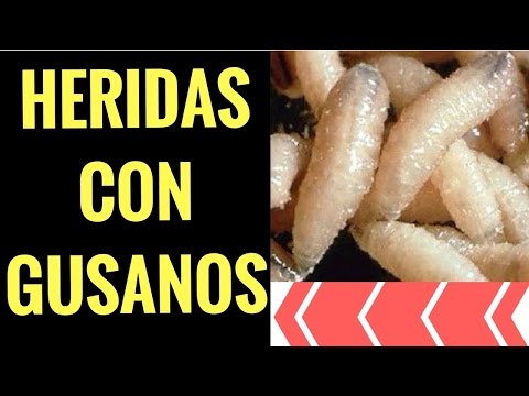 Video: Cómo Deshacerse De Los Gusanos En Los Cachorros