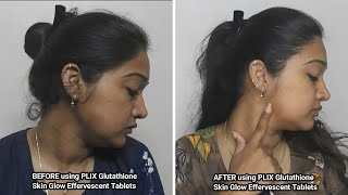 Best Glutathione Tablets? Comparing Plix, Setu & Chicnutrix Glutathione skin whitening tablets Best Glutathione Tablets? Comparing Plix, Setu & Chicnutrix Glutathione skin whitening tablets