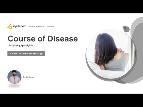 Video: Bechterew's Disease In Women And Men - Symptoms And Treatment