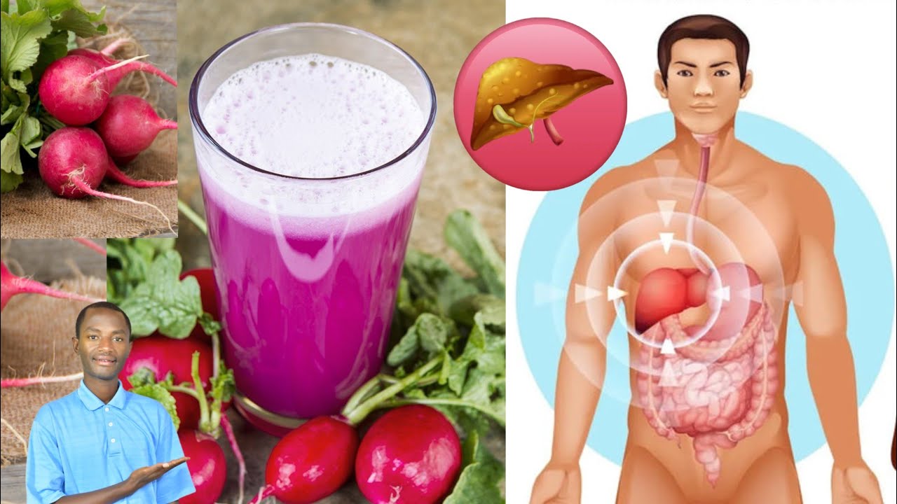 Benshi bararwaye kubera kutamenya Radi/radis. IVURA umwijima, ubuhumekero bwose.