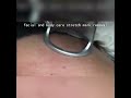 New design Portable Fractional Co2 Laser machine #skincare #laserbeauty