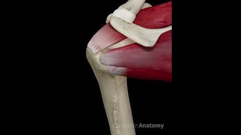Rotator Cuff Tear