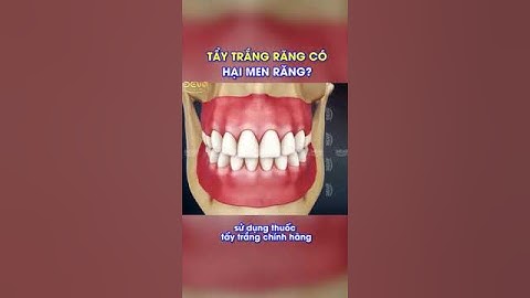 Tẩy trắng răng có hại men răng không?